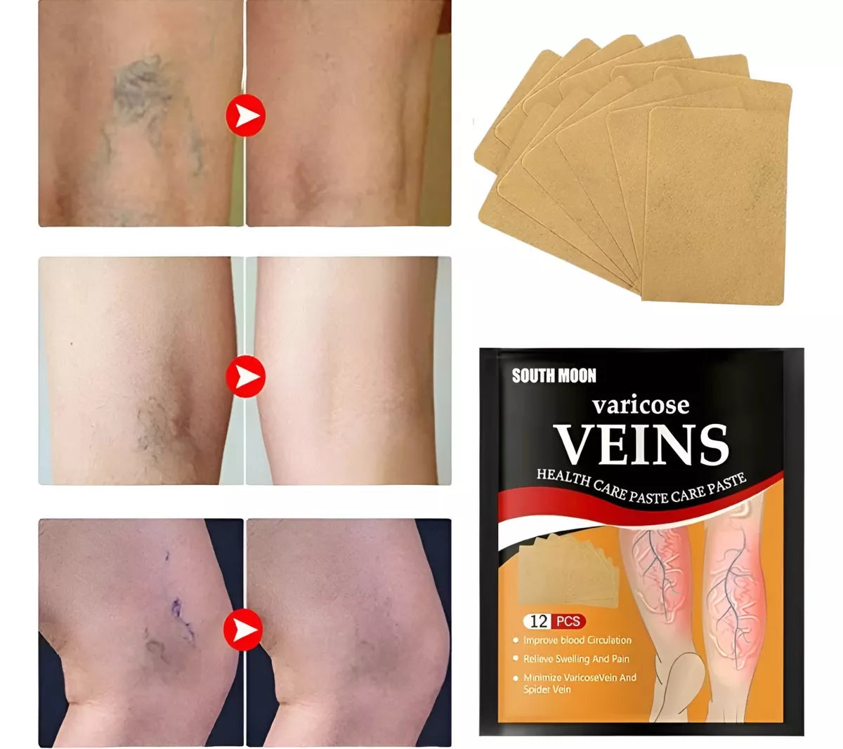 💆♀️🩹 Parches para Várices x4 – Alivio y Cuidado para tus Piernas